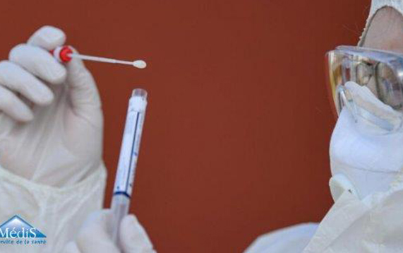 C’est quoi la différence entre Tests PCR et Tests Sérologiques ou Tests Rapides ?