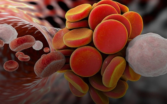 Anticoagulant treatment is associated with a reduction in mortality in patients with severe forms of COVID-19 and suffering from coagulopathy